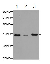 Western blot - Anti-PSRC1/DDA3 antibody (AB187199)