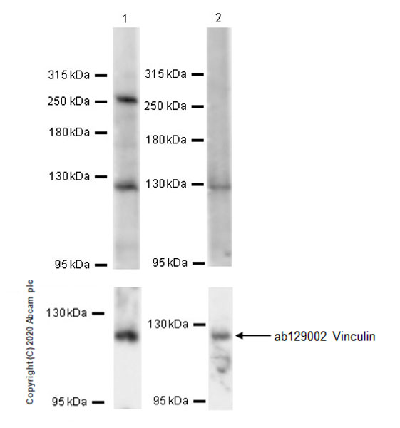 Western blot - Anti-PSRC2 antibody [EPR20913-32] - BSA and Azide free (AB270035)