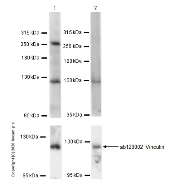 Western blot - Anti-PSRC2 antibody [EPR20913-32] - BSA and Azide free (AB270035)