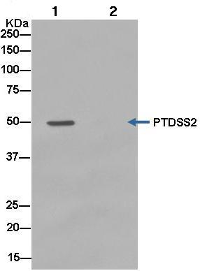 Immunoprecipitation - Anti-PSS-2 antibody [EPR14663] - C-terminal (AB183504)