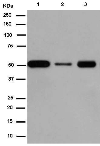 Western blot - Anti-PSS-2 antibody [EPR14663] - C-terminal (AB183504)