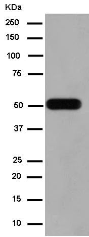 Western blot - Anti-PSS-2 antibody [EPR14663] - C-terminal (AB183504)