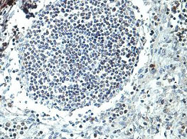Immunohistochemistry (Formalin/PFA-fixed paraffin-embedded sections) - Anti-PSTPIP1 antibody (AB197260)
