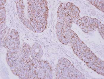 Immunohistochemistry (Formalin/PFA-fixed paraffin-embedded sections) - Anti-PSTPIP2 antibody (AB155543), expandable thumbnail