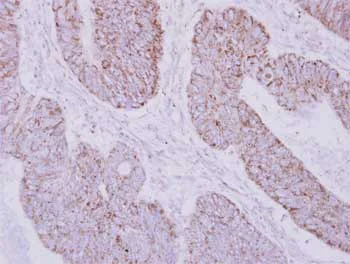 Immunohistochemistry (Formalin/PFA-fixed paraffin-embedded sections) - Anti-PSTPIP2 antibody (AB155543)