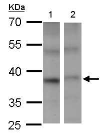 Western blot - Anti-PSTPIP2 antibody (AB155543), expandable thumbnail