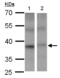 Western blot - Anti-PSTPIP2 antibody (AB155543)