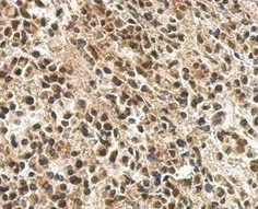 Immunohistochemistry (Formalin/PFA-fixed paraffin-embedded sections) - Anti-PTBP1 antibody (AB154887)