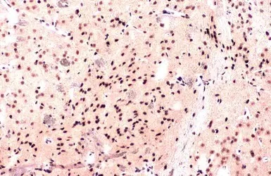 Immunohistochemistry (Formalin/PFA-fixed paraffin-embedded sections) - Anti-PTBP1 antibody (AB154887)