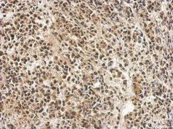 Immunohistochemistry (Formalin/PFA-fixed paraffin-embedded sections) - Anti-PTBP1 antibody (AB154887)