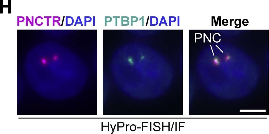 Immunocytochemistry/ Immunofluorescence - Anti-PTBP1 antibody [EPR9048(B)] (AB133734)