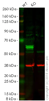 Western blot - Anti-PTBP1 antibody [EPR9048(B)] (AB133734)