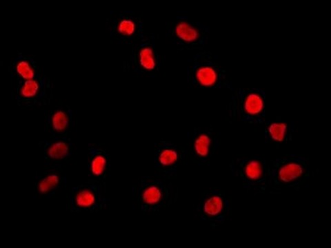 Immunocytochemistry/ Immunofluorescence - Anti-PTBP1 antibody [EPR9048(B)] - BSA and Azide free (AB240079), expandable thumbnail