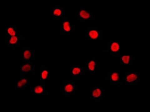 Immunocytochemistry/ Immunofluorescence - Anti-PTBP1 antibody [EPR9048(B)] - BSA and Azide free (AB240079)