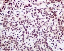 Immunohistochemistry (Formalin/PFA-fixed paraffin-embedded sections) - Anti-PTBP1 antibody [EPR9048(B)] - BSA and Azide free (AB240079), expandable thumbnail