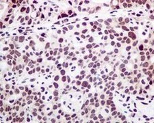 Immunohistochemistry (Formalin/PFA-fixed paraffin-embedded sections) - Anti-PTBP1 antibody [EPR9048(B)] - BSA and Azide free (AB240079)