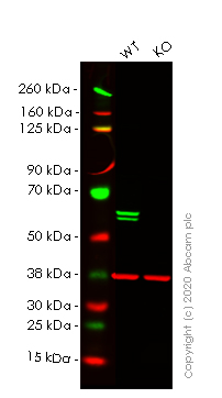 Western blot - Anti-PTBP1 antibody [EPR9048(B)] - BSA and Azide free (AB240079), expandable thumbnail