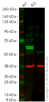 Western blot - Anti-PTBP1 antibody [EPR9048(B)] - BSA and Azide free (AB240079), expandable thumbnail