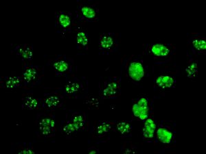 Immunocytochemistry/ Immunofluorescence - Anti-PTBP1 antibody [EPR9049(B)] (AB134950)