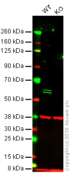 Western blot - Anti-PTBP1 antibody [EPR9049(B)] (AB134950)