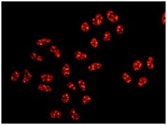 Immunocytochemistry/ Immunofluorescence - Anti-PTBP1 + PTBP2 + PTBP3 antibody [EPR9890] (AB154787)