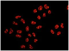 Immunocytochemistry/ Immunofluorescence - Anti-PTBP1 + PTBP2 + PTBP3 antibody [EPR9890] (AB154787)