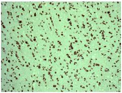 Immunohistochemistry (Formalin/PFA-fixed paraffin-embedded sections) - Anti-PTBP1 + PTBP2 + PTBP3 antibody [EPR9890] (AB154787)