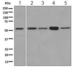 Western blot - Anti-PTBP1 + PTBP2 + PTBP3 antibody [EPR9890] (AB154787)