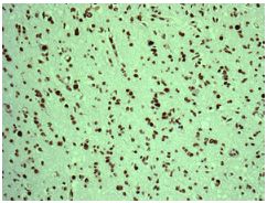 Immunohistochemistry (Formalin/PFA-fixed paraffin-embedded sections) - Anti-PTBP2 antibody [EPR9890] (AB154787)