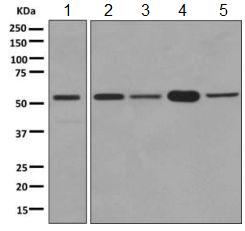 Western blot - Anti-PTBP2 antibody [EPR9890] (AB154787)