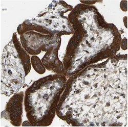 Immunohistochemistry (Formalin/PFA-fixed paraffin-embedded sections) - Anti-PTCD1 antibody (AB121620)