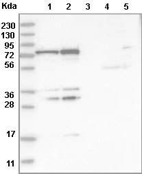 Western blot - Anti-PTCD1 antibody (AB121620)