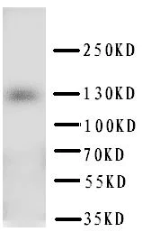 Western blot - Anti-PTCH2 antibody (AB151775)