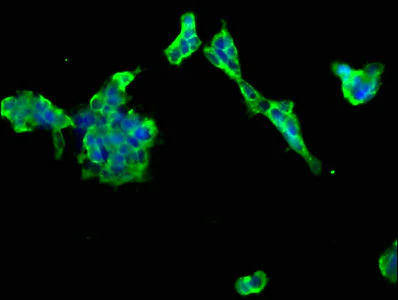 Immunocytochemistry/ Immunofluorescence - Anti-PTCH2 antibody (AB238338)
