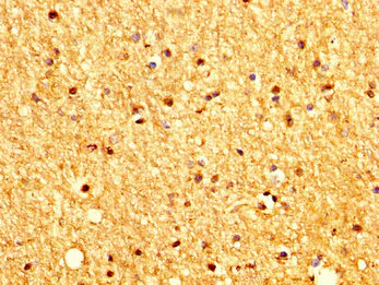 Immunohistochemistry (Formalin/PFA-fixed paraffin-embedded sections) - Anti-PTCH2 antibody (AB238338)