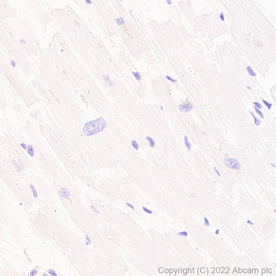 Immunohistochemistry (Formalin/PFA-fixed paraffin-embedded sections) - Anti-PTCH2 antibody [EPR26073-39] (AB300036)