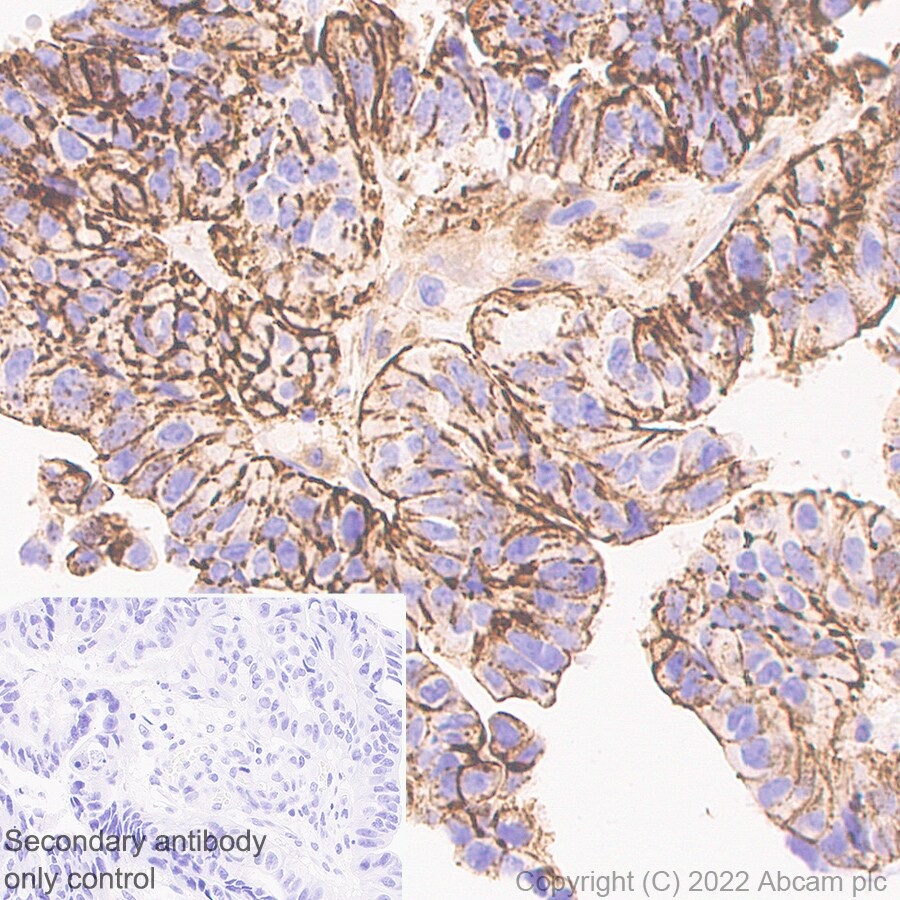 Immunohistochemistry (Formalin/PFA-fixed paraffin-embedded sections) - Anti-PTCH2 antibody [EPR26073-39] - BSA and Azide free (AB300037)
