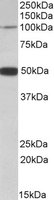 Western blot - Anti-PTCHD1 antibody (AB109407), expandable thumbnail