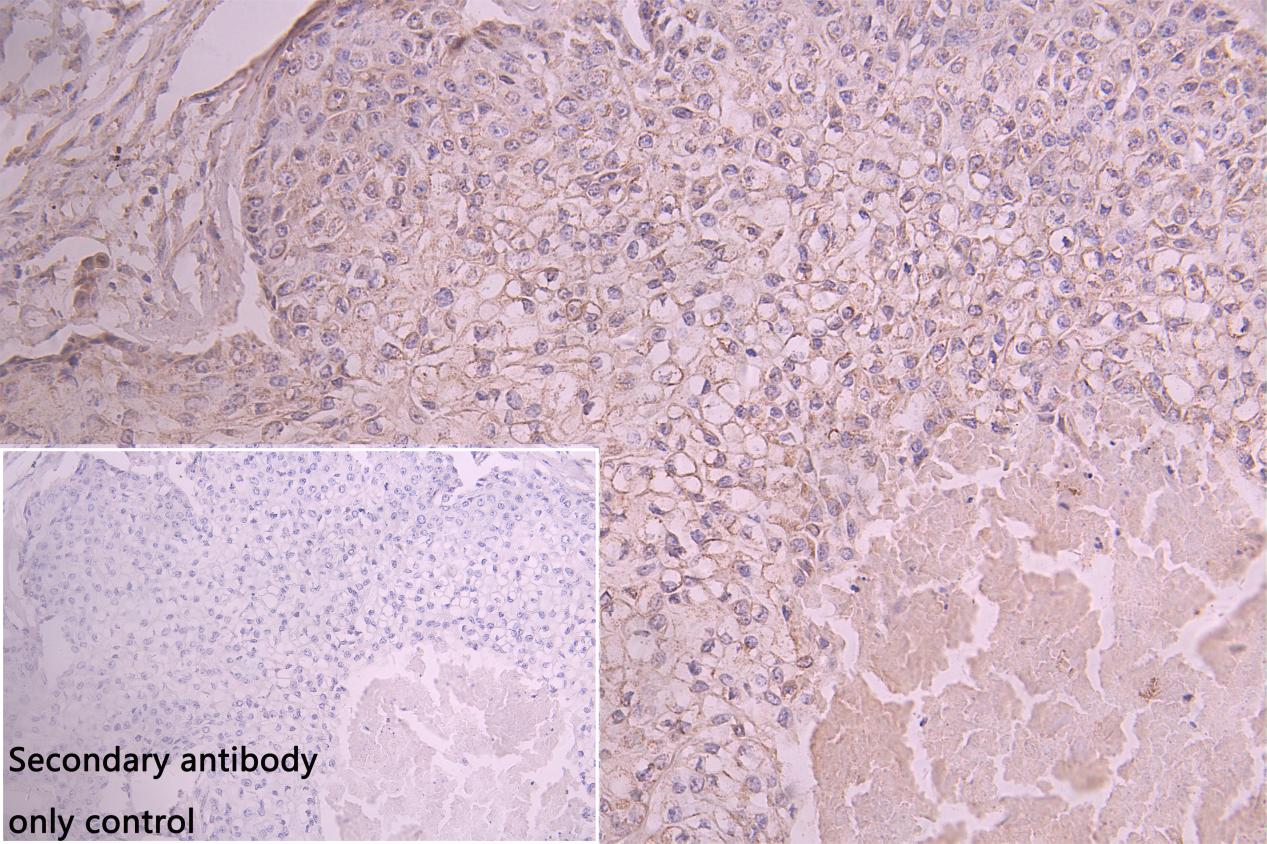 Immunohistochemistry (Formalin/PFA-fixed paraffin-embedded sections) - Anti-PTDSS1 antibody (AB237019)