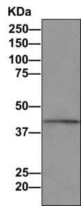 Immunoprecipitation - Anti-PTDSS1 antibody [EPR8118(2)] - BSA and Azide free (AB249322)