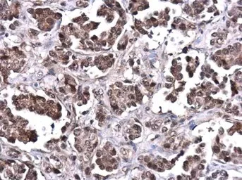 Immunohistochemistry (Formalin/PFA-fixed paraffin-embedded sections) - Anti-PTEN antibody (AB137337)