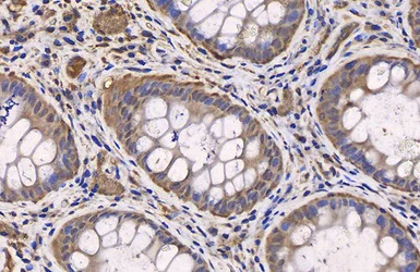 Immunohistochemistry (Formalin/PFA-fixed paraffin-embedded sections) - Anti-PTEN antibody (AB137337)
