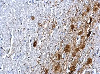 Immunohistochemistry (Formalin/PFA-fixed paraffin-embedded sections) - Anti-PTEN antibody (AB137337)