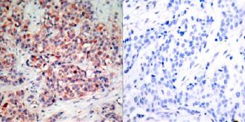 Immunohistochemistry (Formalin/PFA-fixed paraffin-embedded sections) - Anti-PTEN antibody (AB31392), expandable thumbnail
