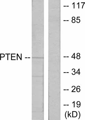 Western blot - Anti-PTEN antibody (AB31392), expandable thumbnail
