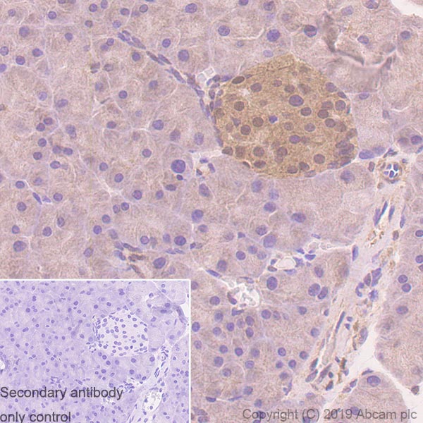 Immunohistochemistry (Formalin/PFA-fixed paraffin-embedded sections) - Anti-PTEN antibody [EPR22636-122] - BSA and Azide free (ab267791), expandable thumbnail
