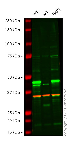 Western blot - Anti-PTEN antibody [EPR4408-76] (AB133532), expandable thumbnail