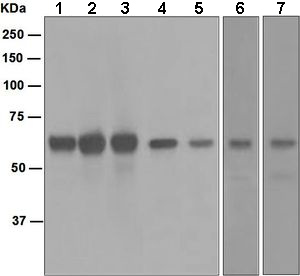 Western blot - Anti-PTEN antibody [EPR4408-76] (AB133532), expandable thumbnail