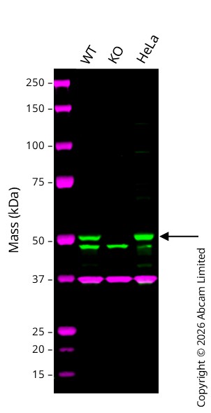 Western blot - Anti-PTEN antibody [EPR4408-76] (AB133532)