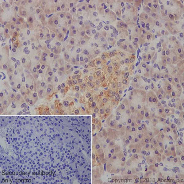 Immunohistochemistry (Formalin/PFA-fixed paraffin-embedded sections) - Anti-PTEN antibody [EPR9941-2] (AB170941)